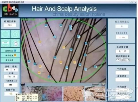 毛发检测影像