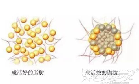 脂肪成活图