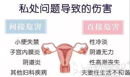 产后阴道松弛怎么办？做了阴道紧缩术后能维持多久？