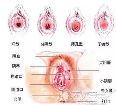 处女膜所在位置