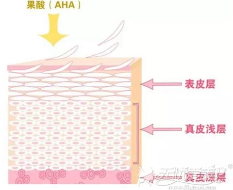 果酸换肤的原理