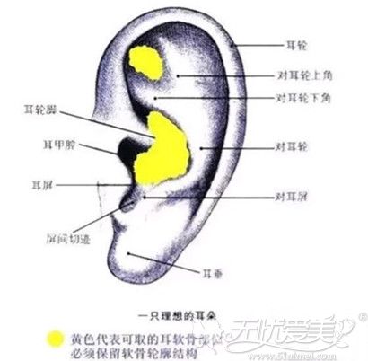 耳软骨隆鼻取用甲耳腔部位组织