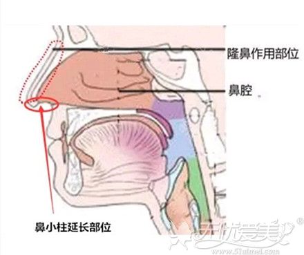 鼻小柱延长手术也是鼻整形不可忽视的一个位置