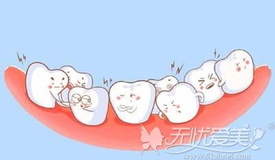 错颌畸形的伤害