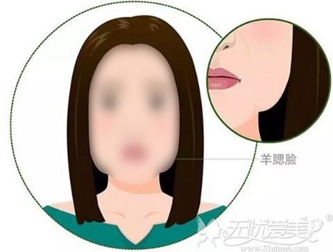 羊腮脸是什么?是什么原因导致的?该如何解决?