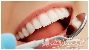 洗牙多少钱一次?洗牙会牙齿敏感、损伤牙龈、让牙缝变大吗?