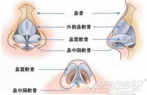 鼻综合手术过程