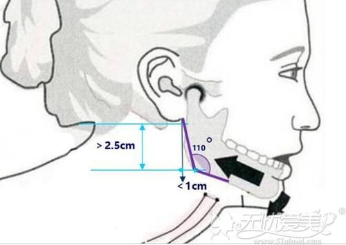 下颌角突出的位置