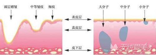 不同分子玻尿酸作用