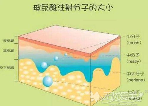 玻尿酸的分子大小种类