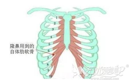 全肋骨隆鼻所需的肋骨