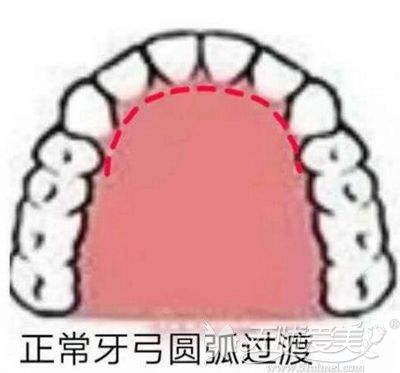 牙弓弧度不对称且一侧牙齿舌倾 做舌侧牙齿矫正能改善吗?