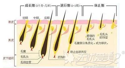 电波密发的适应人群