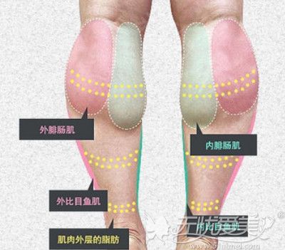 小腿肌肉阻断术位置