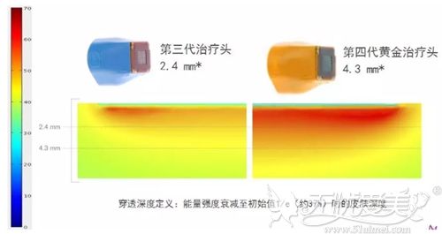 热玛吉深入皮肤的层次