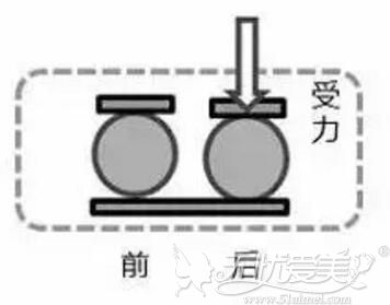 瑞蓝3号·丽瑅凝胶弹性更好