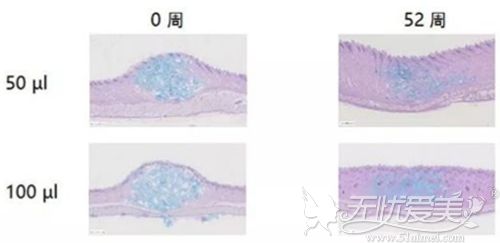 瑞蓝3号·丽瑅凝胶维持时间更长