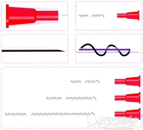 PPDO双螺旋线