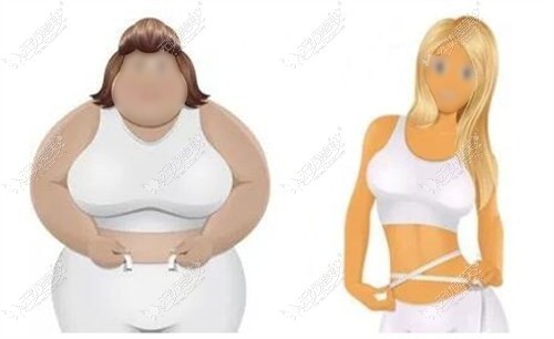 腰腹环吸手术能减少脂肪