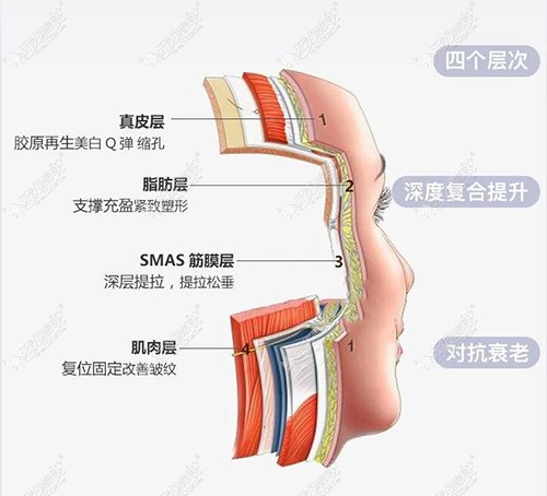 埋线提升可到达的层次