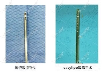 easylipo吸脂手术针头