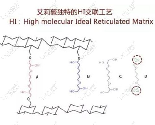 艾莉薇风尚玻尿酸可以用来打下巴