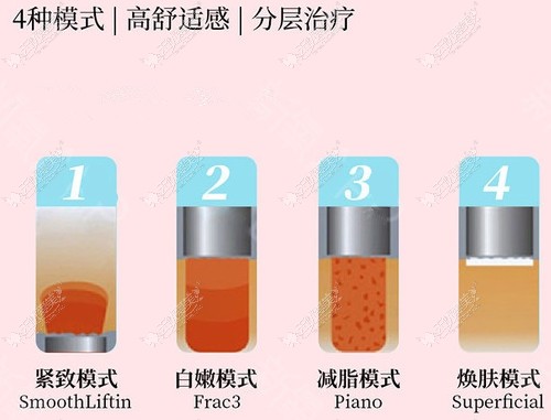 欧洲之星做Fotona火凤凰溶脂的四个模式