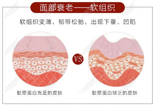 爱贝芙可以改善肌肤问题