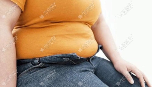 腰腹肥胖可以做酷塑冷冻溶脂