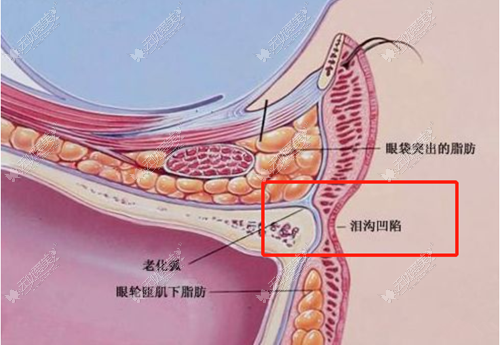 嗨体注射层次技巧图片