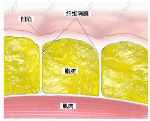 面部吸脂后失败做修复原理