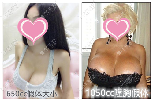 650cc和1050cc隆胸假体对比