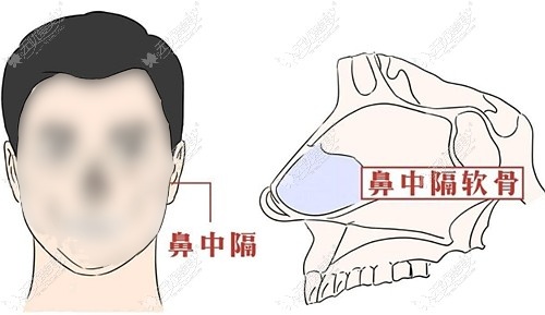 舒铂超肋适合垫鼻子哪里