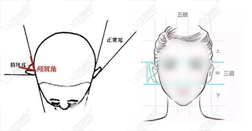 精灵耳效果图