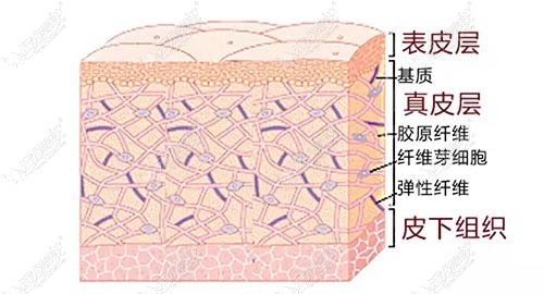 埋线提升面部