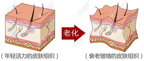 筋膜层衰老