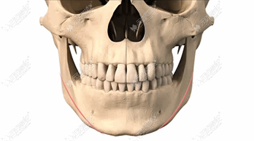 你知道郑州磨骨手术好的医院做下颌角整形的价格是多少吗