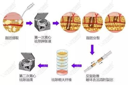 脂肪胶过程