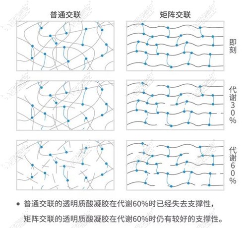 艾莉薇传奇玻尿酸的优势