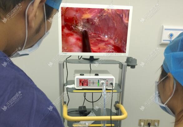 拉皮手术使用内窥镜仪器