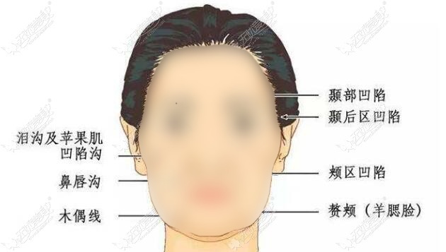 3d网状提升术解决的衰老问题