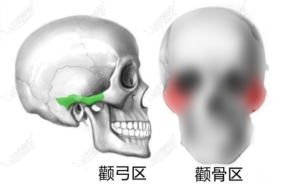颧骨和颧弓的不同部位