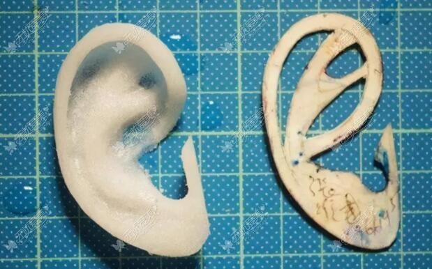 曼特波生物材料耳支架图片