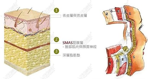 pst面部提升部位