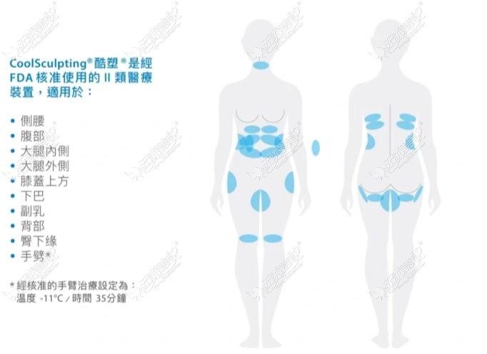 吸脂部位图解