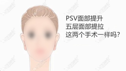 psv面部提升和五层提拉一样吗?手术切口/价格/维持时间都不同