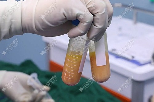汕头吸脂好的医院排名 汕头吸脂好的医院排名