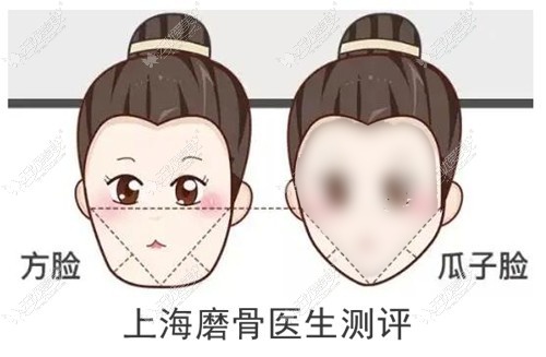 上海磨骨医生排名测评:上海李志海/穆雄铮做下颌角好人气高