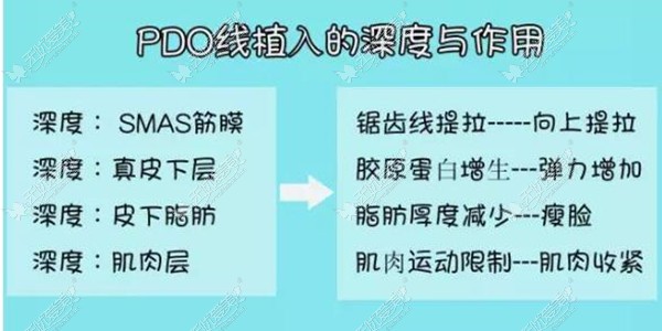 埋线提升的线材深度与作用