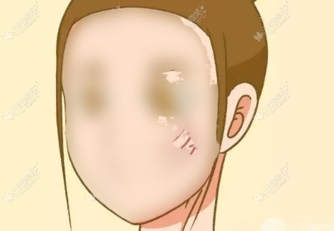 沈阳哪个整形医院面部拉皮技术好?拉皮做得好医院是名流…